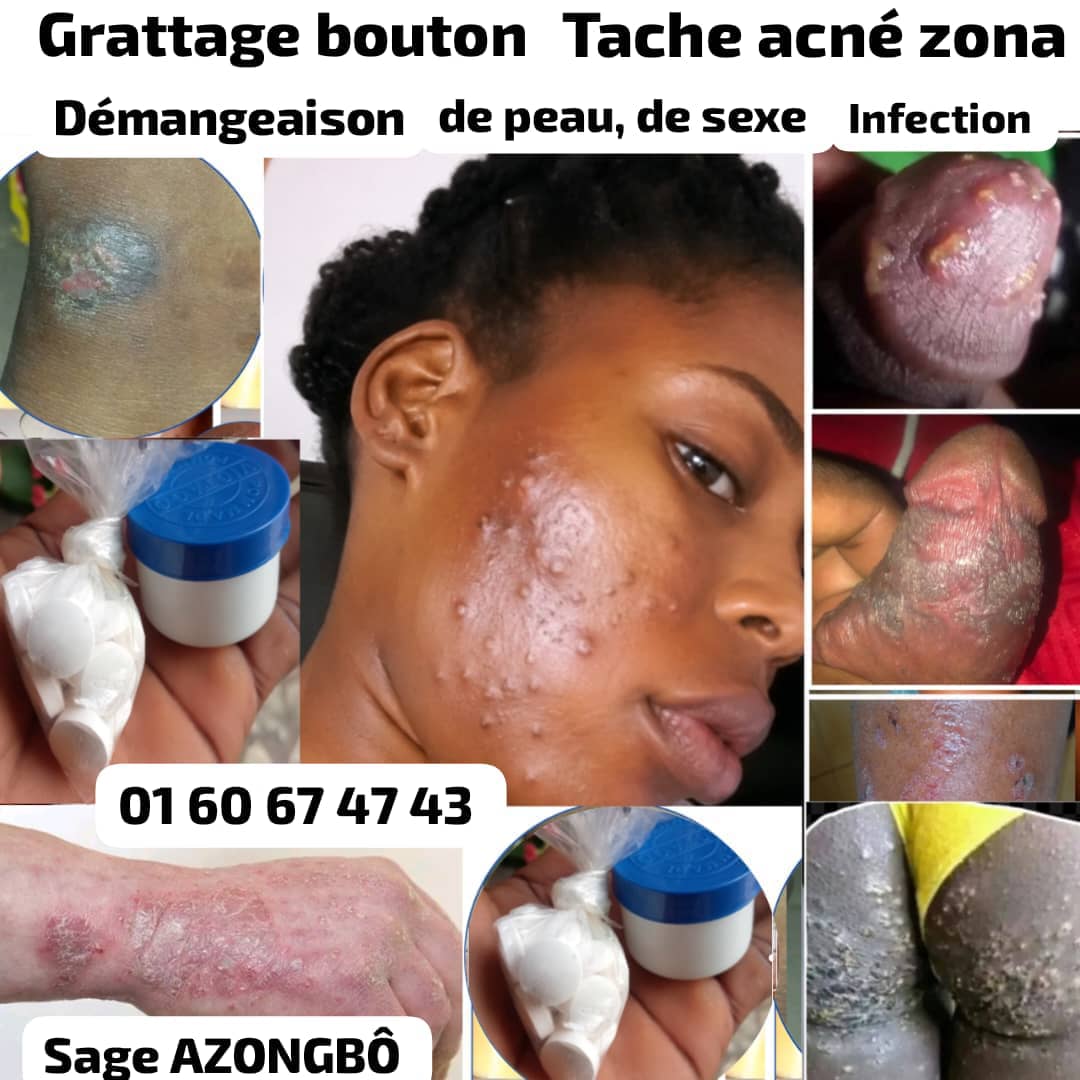 Maladie de peau 